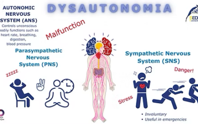 What is Dysautonomia